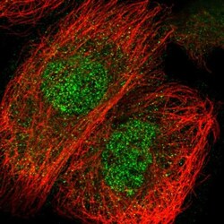 C2CD2 Antibody, Novus Biologicals:Antibodies:Primary Antibodies